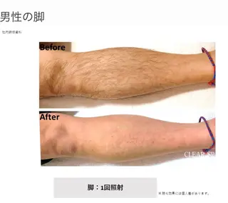 【痩身・脱毛】private salon Eclat所属・伊藤 心のエステ・リラクイメージ