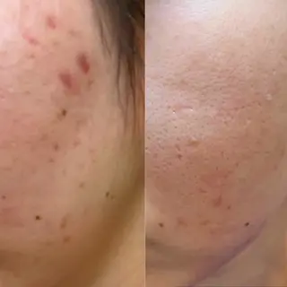 salon 398所属・salon 398 Kyokoのマツエク・マツパデザイン