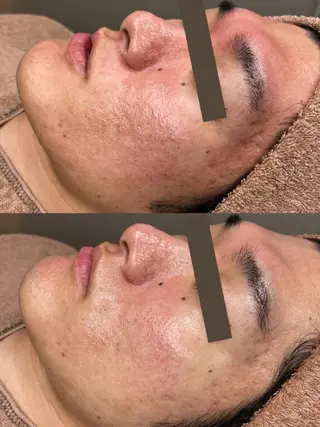 渋谷小顔矯正 毛穴洗浄ウミのエステ・リラクイメージ