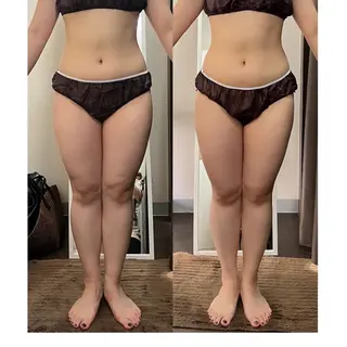 ハイパーナイフ専門店　Salon de COCO所属・Salon de COCOのエステ・リラクイメージ