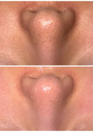 本格派エステ ハピスリーのエステ・リラクイメージ