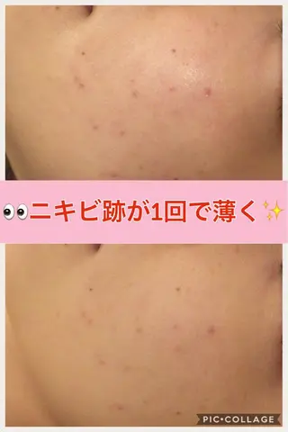 ショート カラー パーマ ヘアアレンジ メンズ キッズ ネイル マツエク・マツパ ニキビ・肌質改善専門 ♡人生が変わるサロンのエステ・リラクイメージ