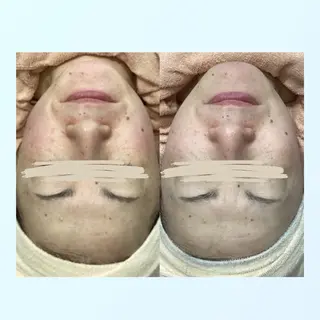 肌専門パーソナルエステサロンみゅうる所属・田村 由佳のその他イメージ