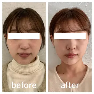 小顔サロン AMYONのエステ・リラクイメージ