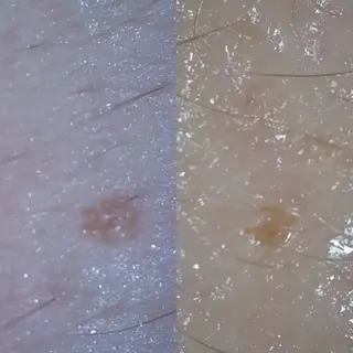 デアイム東広島所属・中井 小春のエステ・リラクイメージ