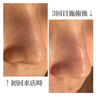 メンズ眉毛サロンラボ所属・メンズ眉毛サロンラボ 🫧 牧田 雪乃の眉毛・アイブロウイメージ