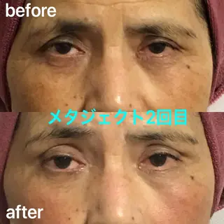 氣楽所属・松下 さゆりのエステ・リラクイメージ