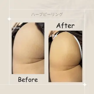 ピーリング専門店 Belluteのエステ・リラクイメージ