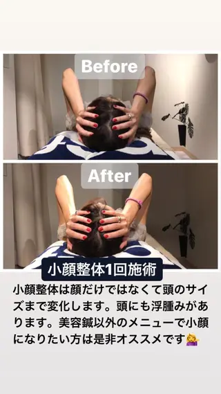 鍼灸整骨院Refine所属・鍼灸 Refineのその他イメージ