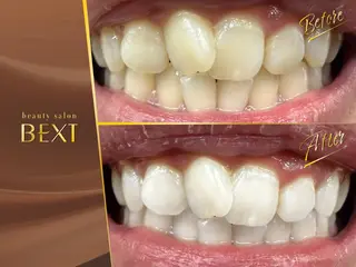 メンズ ビューティーサロンベクスト beautysalonBEXT所属・ビューティーサロン ベクスト名古屋のエステ・リラクイメージ