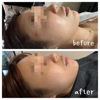 肌質改善Beauty salon Renのエステ・リラクイメージ