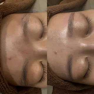 アイブロウ salonvilla所属・villa ☺︎草山 楓花のエステ・リラクイメージ