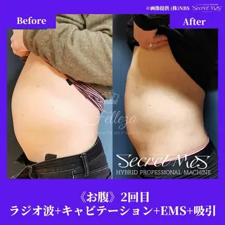 メンズ 有人型セルフサロン 脱毛/痩身/美顔のその他イメージ