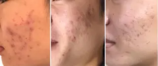 【EARTH鳥栖店】 小松美穂子のエステ・リラクイメージ