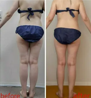 【 Laforme】 ラ・フォルムのエステ・リラクイメージ