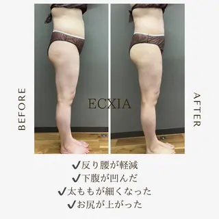 ECXIA 【エクシア】のエステ・リラクイメージ