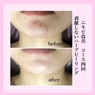 LILIANA所属・LILIANA ☆YURIのエステ・リラクイメージ