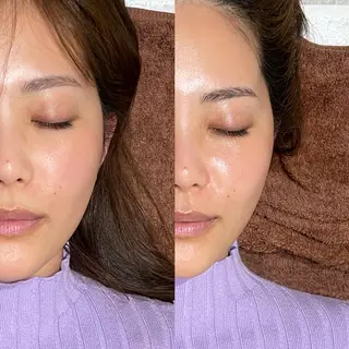 mieux所属・ハーブピーリング ¥6600のエステ・リラクイメージ