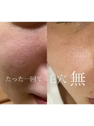 プライベートサロン Belle（ベル）のエステ・リラクイメージ