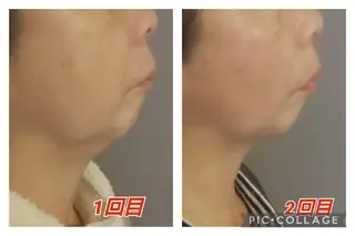 beauty salon    向日葵所属・beauty  salon 向日葵のエステ・リラクイメージ