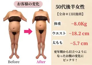 Belle White所属・本格痩身＊肌質改善＊ BelleWhiteのエステ・リラクイメージ