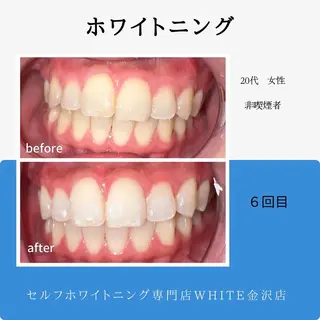 セルフホワイトニング専門店WHITE金沢店所属・伊藤 勢のエステ・リラクイメージ