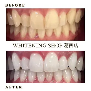 ホワイトニング ショップ葛西店のその他イメージ