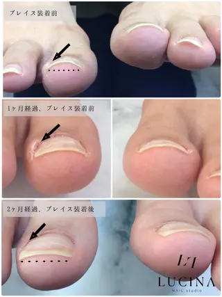 ネイル 新橋 ルキナ スタッフのネイルデザイン