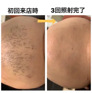 メンズ脱毛サロン Le falcoのエステ・リラクイメージ