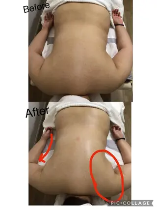 子宮矯正/腸揉み/ シュガーリング脱毛のエステ・リラクイメージ