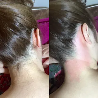 MIX脱毛 リュミエールアンジュのエステ・リラクイメージ