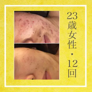 ミディアム カラー パーマ ヘアアレンジ メンズ キッズ ネイル マツエク・マツパ ニキビ・肌質改善専門 ♡人生が変わるサロンのエステ・リラクイメージ