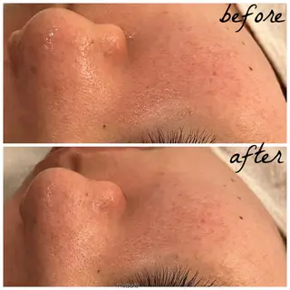 メンズ メナード岐阜市茜部 杉浦のエステ・リラクイメージ