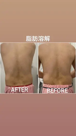 毛穴洗浄・痩身・脱毛 /アルカンジュのエステ・リラクイメージ