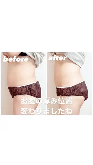 小顔バランス unicaのエステ・リラクイメージ