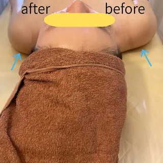 aliaハイフ&水光ジェットサロン所属・aliaハーブ水光店 エステティシャン募集のエステ・リラクイメージ