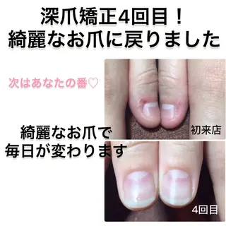 ネイル Nail×Lani 深爪矯正対応◎のネイルデザイン