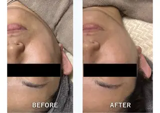 脂肪冷却/美肌改善 COCOKARAのエステ・リラクイメージ