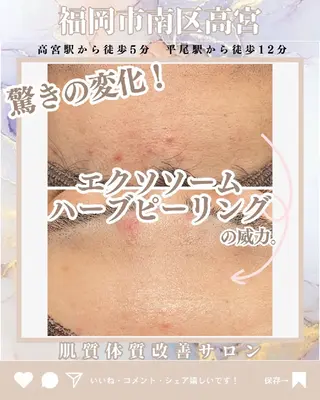 TLIENGLE高宮 エステ・ネイルのエステ・リラクイメージ