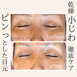 肌質改善エステ chiffonのエステ・リラクイメージ