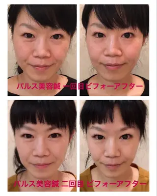 美容鍼サロン    Fleurir所属・伊藤 かなえのエステ・リラクイメージ