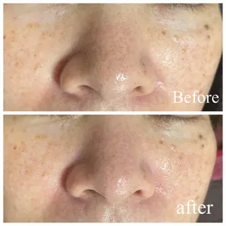 肌質改善サロン facialmoonのエステ・リラクイメージ