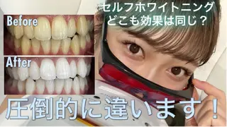 セルフホワイトニング Dolce八王子店のその他イメージ