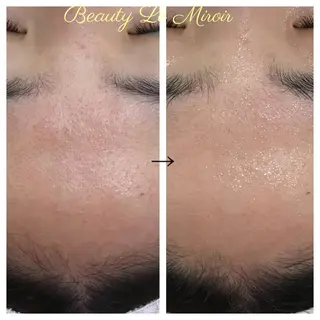 ビューティー ミロワールのエステ・リラクイメージ