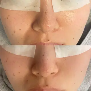 Lien ~beauty salon~所属・福島⌇毛穴専門サロン ⌇﻿モニター募集のエステ・リラクイメージ