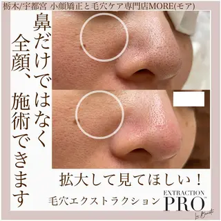 Eyelash salon MORE(モア)所属・安納 麻穂のエステ・リラクイメージ