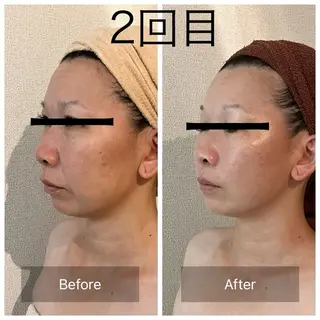 よもぎ蒸しCOCOA M（ココアエム）のその他イメージ