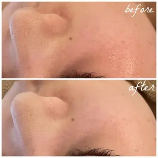 メンズ メナード岐阜市茜部 杉浦のエステ・リラクイメージ