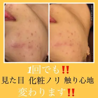 ミディアム カラー パーマ ヘアアレンジ メンズ キッズ ネイル マツエク・マツパ ニキビ・肌質改善専門 ♡人生が変わるサロンのエステ・リラクイメージ