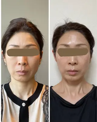 detoxサロン am.（アン.）のエステ・リラクイメージ